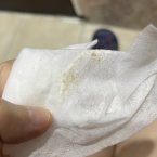 У меня сегодня 20 день после эко маленькие каричневые выделения