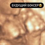 )))