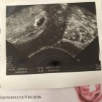 Моя точка в 6 неделек ❤️❤️❤️ а сейчас уже на экран не помещается
