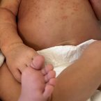 Пройдет , чего толко не высыпало у нас в первый месяц. В роддоме