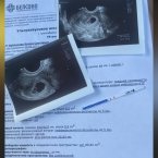 Смотрите мне так же писали, я платно делаю УЗИ всегда