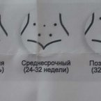 Можно, после 12й недели купила Доплер, в комплекте была инструкц