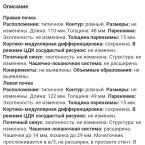 вот моё узи почек от 5го числа, но это после операции прошло 5 м