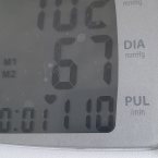 Это за сегодняшний день. Пол дня было плохо, потом пол дня вроде